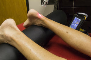 Diabetic Neuropathy Laser