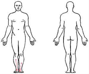 extensor digitorum longus trigger point