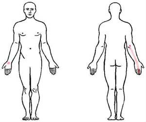 extensor digitorum trigger point