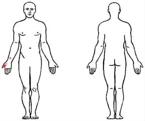flexor pollicis longus trigger point