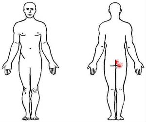 gluteus maximus trigger point