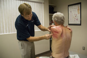 Graston Technique for Shoulder Injuries