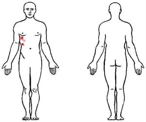 intercostals trigger point