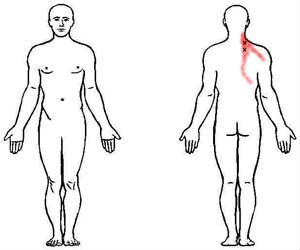levator scapulae trigger point