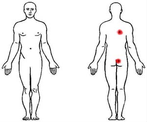 multifidi trigger point