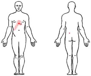 obliquus externus abdominis trigger point