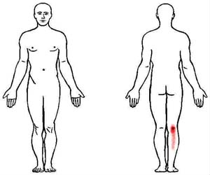 plantaris trigger point