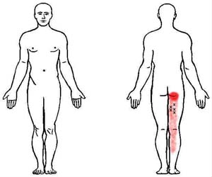 semimembranosus trigger point