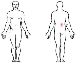 serratus posterior inferior trigger point