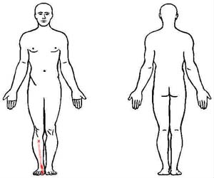 tibialis anterior trigger point