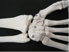 trauma to your thumb